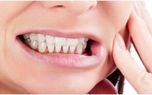راه های سفید کردن دندان طبق دستور طب ایرانی چیست؟